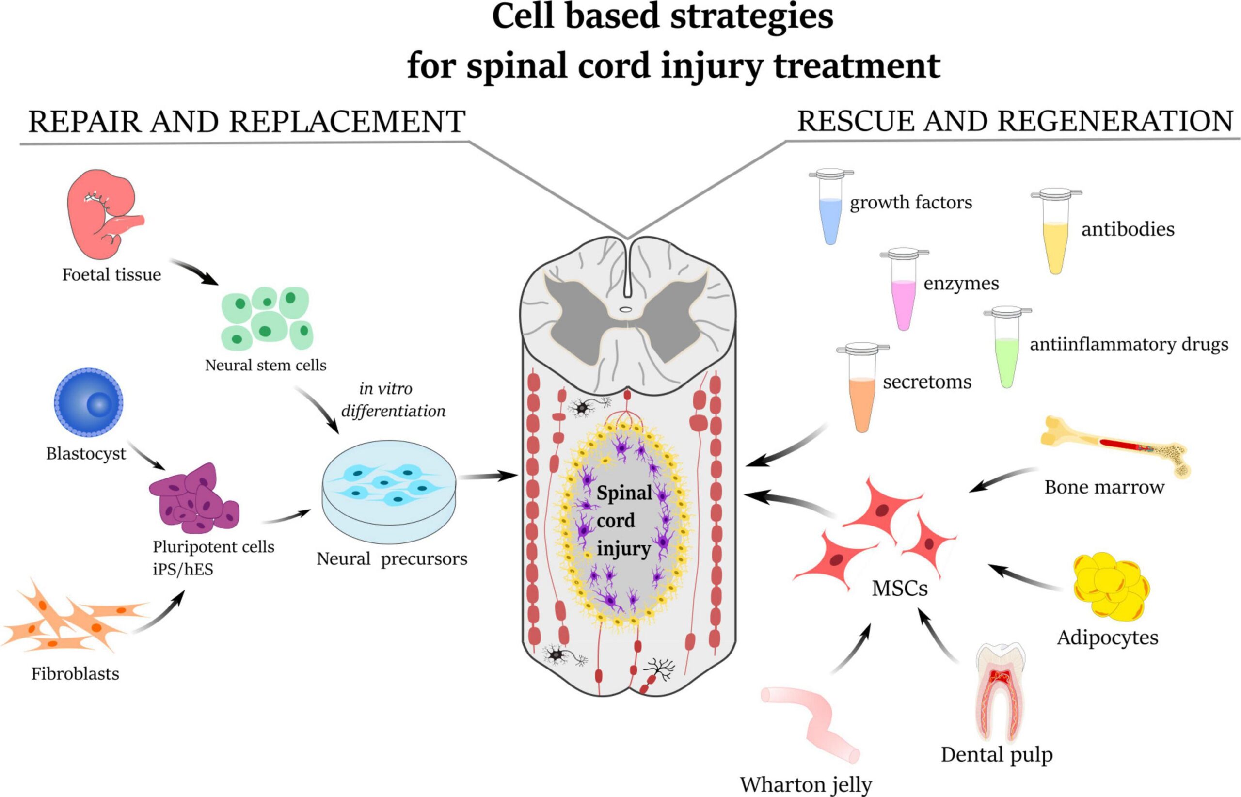 Improvements from Stem Cell Therapy After Spinal Cord Injury: A Study on Safety and Effectiveness