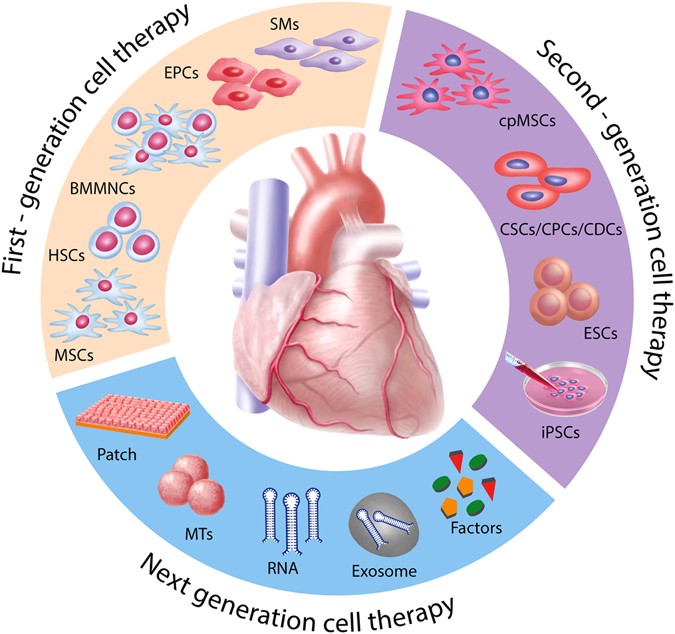 Rapid Advances in Stem Cell Therapies for Heart Healing