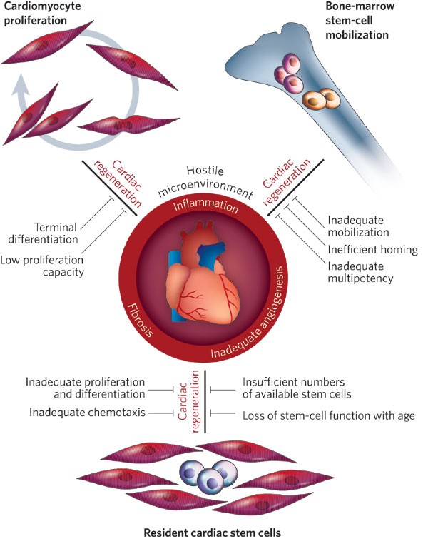 Rapid Advances in Stem Cell Therapies for Heart Healing