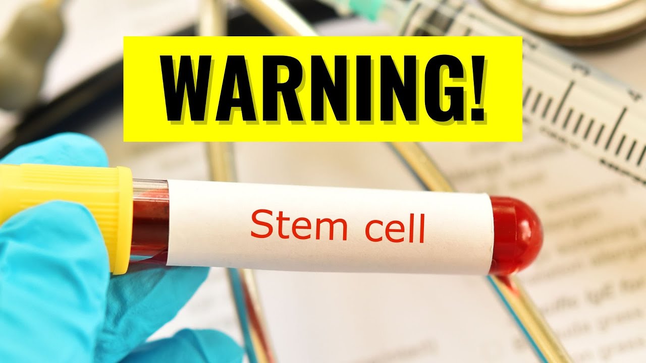 The Truth About Stem Cell Therapy For Arthritis