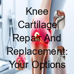 Knee Cartilage Repair and Replacement: Your Options